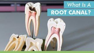 What Is A Root Canal? -- Mark Burhenne DDS Of Ask The Dentist