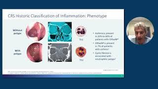 Rhinosinusitis With Nasal Polyps: From Pathophysiology to Management