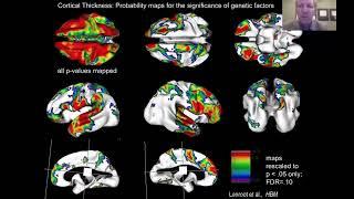 Imaging Genetics and Development: A Whirlwind Tour