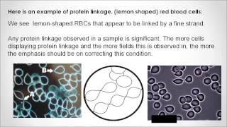 Live Blood Analysis Online Training Course - IS IT FOR YOU?