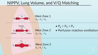 Pulmonary Mechanics in Non-Invasive Positive Pressure Ventilation by B. McAlvin | OPENPediatrics