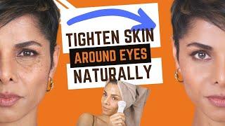 How To Tighten Skin Around Eyes Naturally Without Injecting Fillers