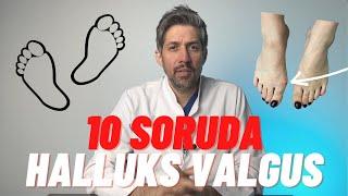 Halluks Valgus(Ayak Başparmak Eğriliği) /Ayağımda Kemik Çıkıntısı Var