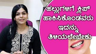 How Do Braces Work to Straighten Your Teeth? | Vijay Karnataka