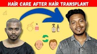 HAIR CARE AFTER HAIR SURGARY,For long term ,My Experience 2k24#hairtransplant