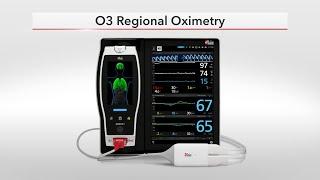 The Benefits of Masimo’s O3® Regional Oximetry