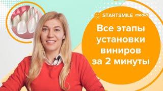 Установка виниров. Как проходит операция?