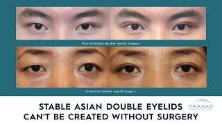 Why a Stable Double Eyelid can't be Created with Non-Surgical Methods