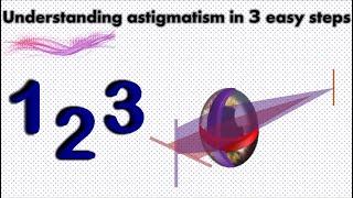 Understanding astigmatism in 3 easy steps