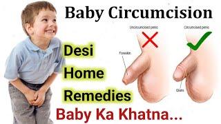 Baby Boy Circumcision | Bache Ka Khatna Home Remedies & Desi Tips | Newborn Baby Milestones