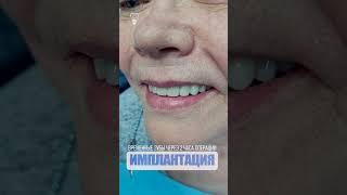 Эстетика временных зубов и постоянных. Aesthetics of temporary and permanent teeth.