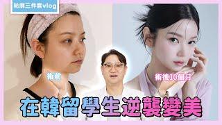 在韓留學生逆襲變美-輪廓三件套手術實錄｜韓國必嫵整形醫院View Plastic Surgery