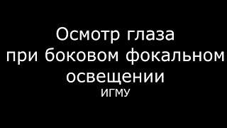 Осмотр глаза при боковом фокальном освещении - meduniver.com