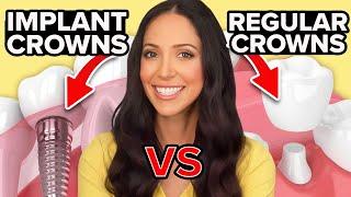 Implant Crowns vs Regular Crowns & How to Clean Them