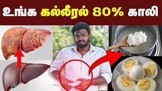 இனிமே சோறு சாப்பிடாதீங்க ஆபத்தாம்| சோறு சாப்பிட்டால் கல்லீரல் பிரச்சனை வருமா? | Fatty liver