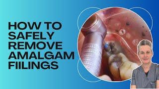 How Are Mercury Amalgam Fillings Removed Safely? [Holistic Dentists Brisbane]