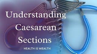 Understanding Caesarean Sections