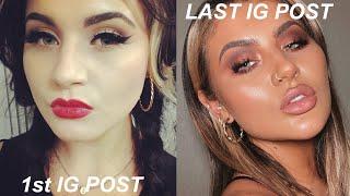 WHAT I'VE HAD DONE - COSMETIC SURGERY & TREATMENTS | JAMIE GENEVIEVE