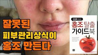 #자미원 #홍조관리 #홍조치료 잘못된 피부관리 상식이 홍조만든다