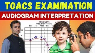 Audiogram interpretation and reading made easy- conductive ,sensorineural, and mixed hearing loss