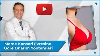 Meme Kanseri Evresine Göre Onarım Yöntemleri Farklı Mıdır? | Meme Kanseri | Doç. Dr. Erdem Güven