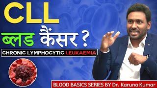 What is CLL Blood Cancer | Types of Leukaemia | High Lymphocyte Count | Dr Karuna Kumar