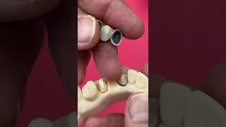 Old dental lab school techniques but still good! @EnvisiontecMain #envisiontec
