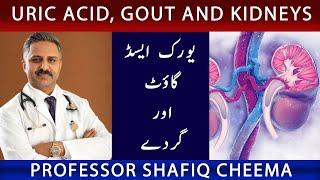 Uric Acid, Gout and Kidneys | NephChat With Dr Shafiq Cheema