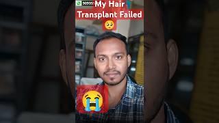 Failure Hair Transplant  To Success STORY#hairtransplantcostinindia #shorts