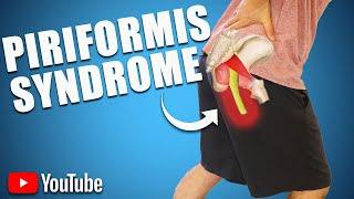 Persistent Buttock Pain. BEST STRETCHES, EXERCISES & ADVICE for PIRIFORMIS SYNDROME..!!