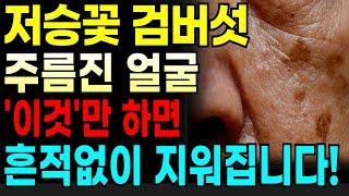 집에서 검버섯,주름 없애는 방법 총8가지! 피부과에 비싼돈 주지마세요! 따라만하면 검버섯과기미,주름까지 싹 다 사라집니다! 검버섯 없애는 좋은 음식! 피부 관리법! #검버섯#주름