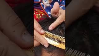 Thousand lice combing - Big lice removal