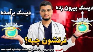 تفاوت دیسک برآمده با بیرون زده و پاره چیست؟| بررسی انواع بیرون زدگی دیسک