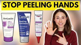 How to STOP SKIN PEELING ON THE HANDS & FEET  Dermatologist @DrDrayzday