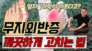 엄지발가락 통증! 간단하게 해결하는 법!  - 김범수의 100세 시대 두 발 혁명 #2 ㅣ무지외반 발가락통증 발통증 스트레칭 발근육강화 발코어근육