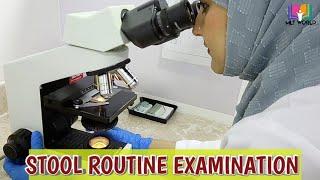 Stool Routine examination.Stool analysis in laboratory. MLT WORLD