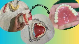 Full denture wax up #dentistry #dental #toothfairy #denture ​⁠@Umairazeem8553