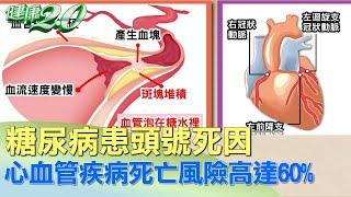 糖尿病患頭號死因 心血管疾病死亡風險高達60%  健康2.0