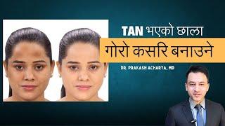 स्कीन Tan कसरी हटाउने? How to remove skin tanning?