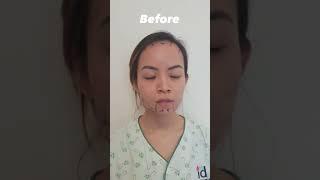 Full Face Transformation