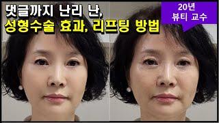 늘어진 턱선 즉각 잡아주는, 혼자 알기 아까운 리프팅 효과