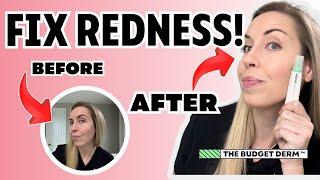 INSTANT RESULTS To Fix Redness Under $15! | The Budget Derm Reviews