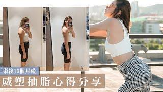 整整瘦了一圈！威塑抽脂想瘦哪就瘦哪｜I got Vaser liposuction.