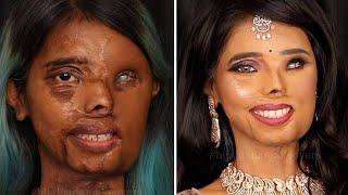 Such an Amazing Makeup Transformation of Acid Attack Survivor Anmol Rodriguez.. 