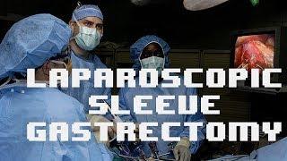 Laparoscopic sleeve gastrectomy