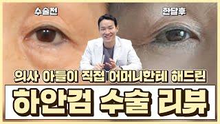 제가 직접 수술한 어머니 하안검 수술 리뷰 해봤습니다│에이비성형외과