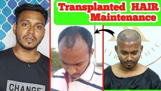 Daily MAINTENANCE Transplanted HAIR Beware Get  Effective Result