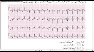 حل تشریحی سوالات آزمون پیش کارورزی #پزشکی شهریور 1400