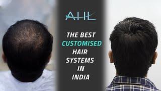 Glue Hair Patch For Men in India | Customized Non Surgical Hair Replacement Systems/Wigs