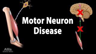 Motor Neuron Disease, Animation